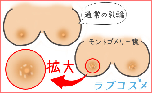 乳輪のぶつぶつのイラスト